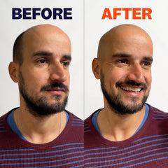 FlexSeries® Shaving Kit